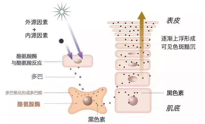 黑色素