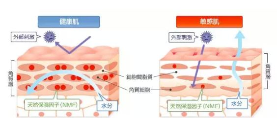 敏感肌肤病理分析