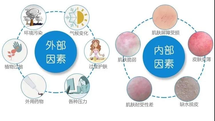 敏感肌肤的主要诱因和潜在群体