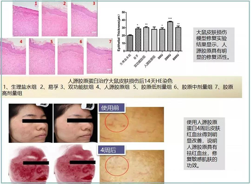 重组人源胶原蛋白的临床试验之修复功效实验